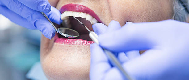 Best Emergency Dental Services for Seniors in Woodville, CA